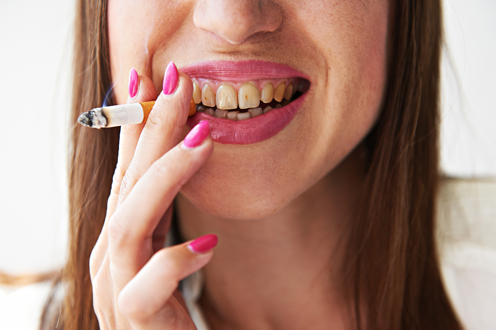 woman with yellow dirty teeth