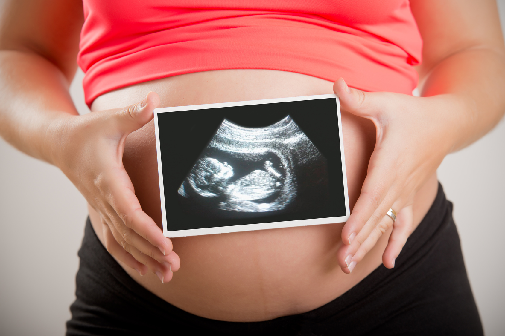 Woman Holding an UltraSound