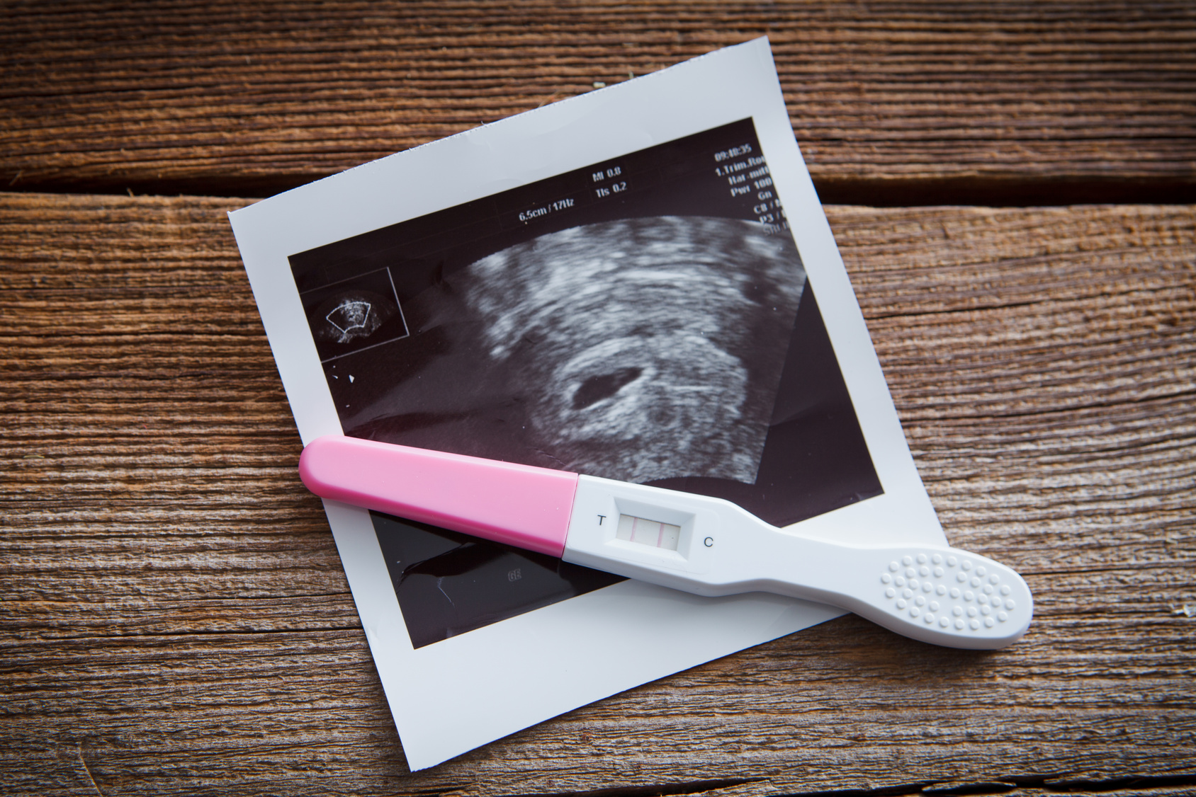 pregnancy test
