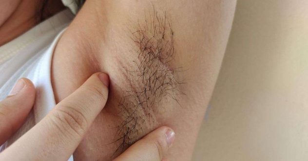 naisen-kainalokarvat